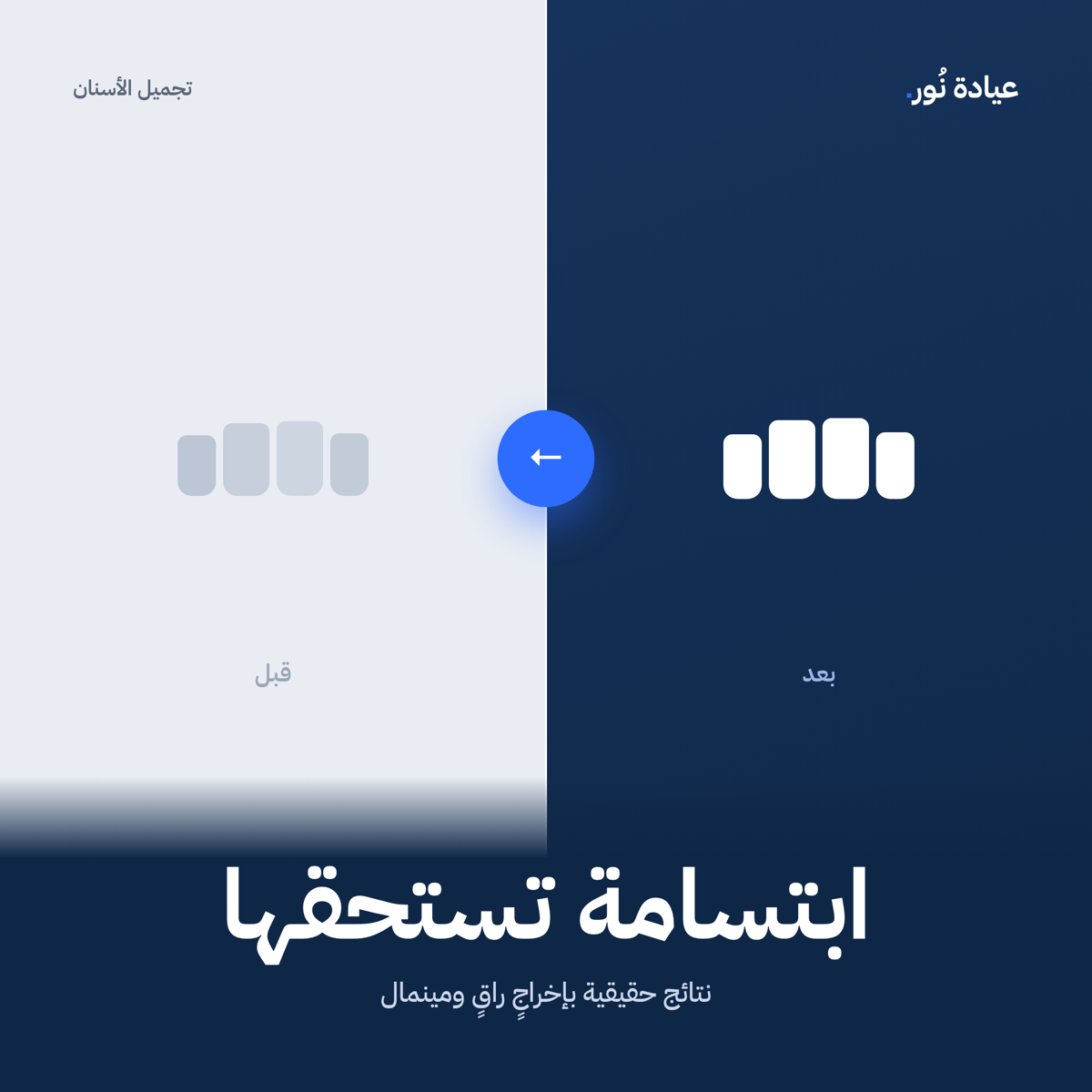 ابتسامة قبل وبعد — عيادة